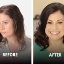 Hairclub - Hair Replacement