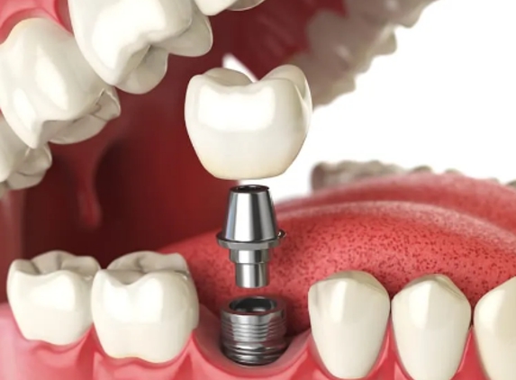 Dentures By Design - Lavington, NSW