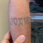 TakeTatt Tattoo Removal