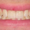 Sheila L. Brush, DDS | Dentist in Germantown, Maryland gallery