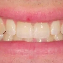 Sheila L. Brush, DDS | Dentist in Germantown, Maryland - Dentists