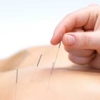Elements Acupuncture gallery