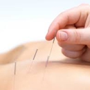 Be Well Acupuncture - Acupuncture