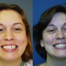 Kellyn Hodges Orthodontics - Implant Dentistry