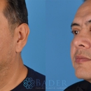 Bader Facial Plastics - Medical Clinics