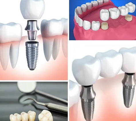 Balgownie Dental Surgery - Balgownie, NSW