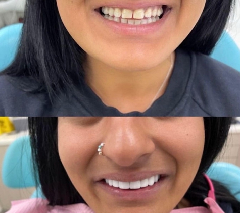 Geelong Dental Group - Belmont - Belmont, VIC. Geelong Dental Group smile make over 1