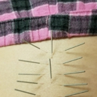 Masuda Acupuncture