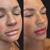 Tulua Medical - Med Spa Services Gilbert Arizona gallery
