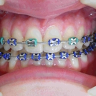 Santelli Orthodontics