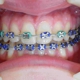 Santelli Orthodontics
