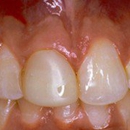 Applebite Dental Care - Dentists