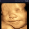 Heavenly 3D 4D Ultrasounds-Upland gallery