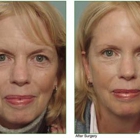 Allcroft Facial Plastic Surgery