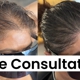 SMP Scalp Micropigmentation CA (SMPCA Academy)