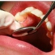 Inlet Smiles Dental Care