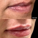 Beyond Esthetics Medspa