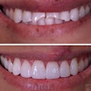 One Dental Studio - Implant Dentistry