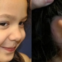 Microtia Congenital Ear Institute