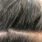 Lice Clinics of America - Modesto