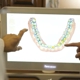 Bekmezian Orthodontics: Costa Mesa Orthodontist - Invisalign Braces