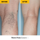 Metro Vein Centers | Long Island, Merrick - Medical Clinics