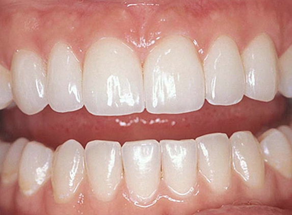 TLC For Gums - Gordon Wilson, DDS - Phoenix, AZ