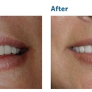 Dupage Dental Smiles - Prosthodontists & Denture Centers