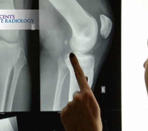 St Vincent's Private Radiology (Formerly CMMI) - Fitzroy, VIC. St Vincent’s Private Radiology offers a comprehensive X-ray service