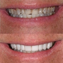 Mississippi Dental Center - Implant Dentistry