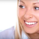 Smile White - Teeth Whitening Products & Services