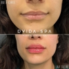 Dvida Med Spa gallery