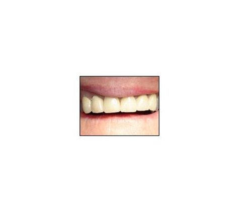 Carseldine Dental - Carseldine, QLD