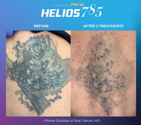Clean Laser Clinics - Teneriffe, QLD