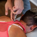 Chiropractic Pain Solutions - Physicians & Surgeons, Acupuncture