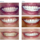 Lacamas Dental - Dental Hygienists