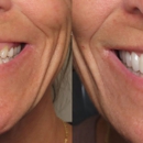 Parke & Rogers Dentistry - Implant Dentistry