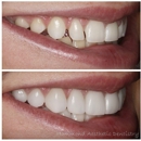 Hammond, Chris A, DMD - Cosmetic Dentistry