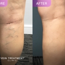 Vein Treatment Clinic | Rockville Centre