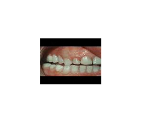 Affordable Denture Clinic - East Geelong, VIC