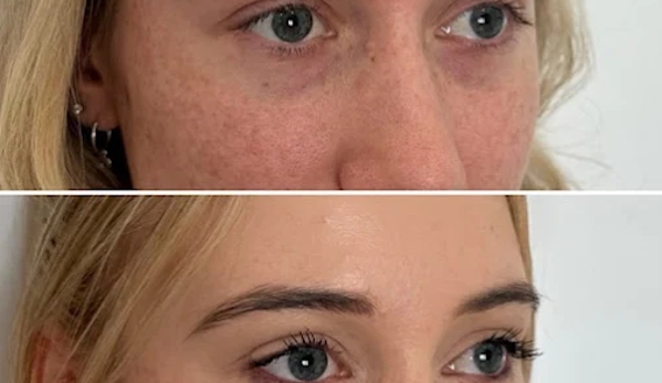 BeautyFULL Cosmetic Medical Clinic - Kingscliff, NSW