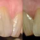 Enhance Family Dental - Implant Dentistry