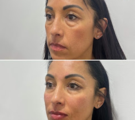 BeautyFULL Cosmetic Medical Clinic Kingscliff - Kingscliff, NSW