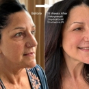 Beverly Wilshire Aesthetics Beverly Hills Medical Spa - Medical Clinics
