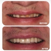 Paramus Dental Arts gallery