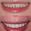 Peninsula Center of Cosmetic Dentistry Los Altos gallery