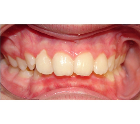 Active Orthodontics - Pialba, QLD