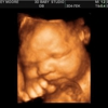 3D Baby Ultrasound Studio gallery