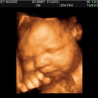 3D Baby Ultrasound Studio