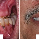 Lamas Dental Specialists - Implant Dentistry